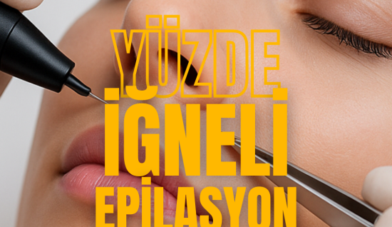 İğneli Epilasyon  Yüzde İnce ve Hormonal Kıllara Kalıcı Çözüm