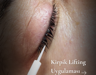 Kirpik Lifting Uygulaması