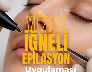 Yüz Bölgesinde Kalıcı Çözüm İğneli Epilasyon Uygulaması